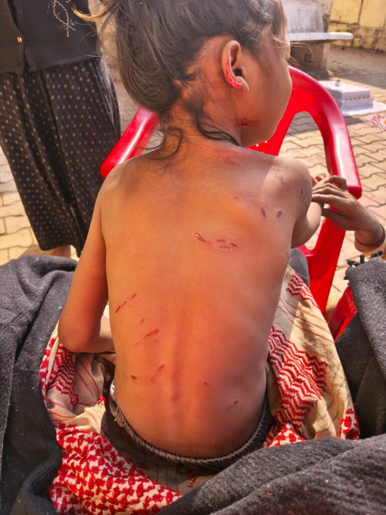 *आवारा कुत्तों के आतंक से दहला दल्ली राजहरा, बच्चे पर हमले के बाद भी एक्शन नहीं* =शहर में दहशत का माहौल, आक्रोश भी =