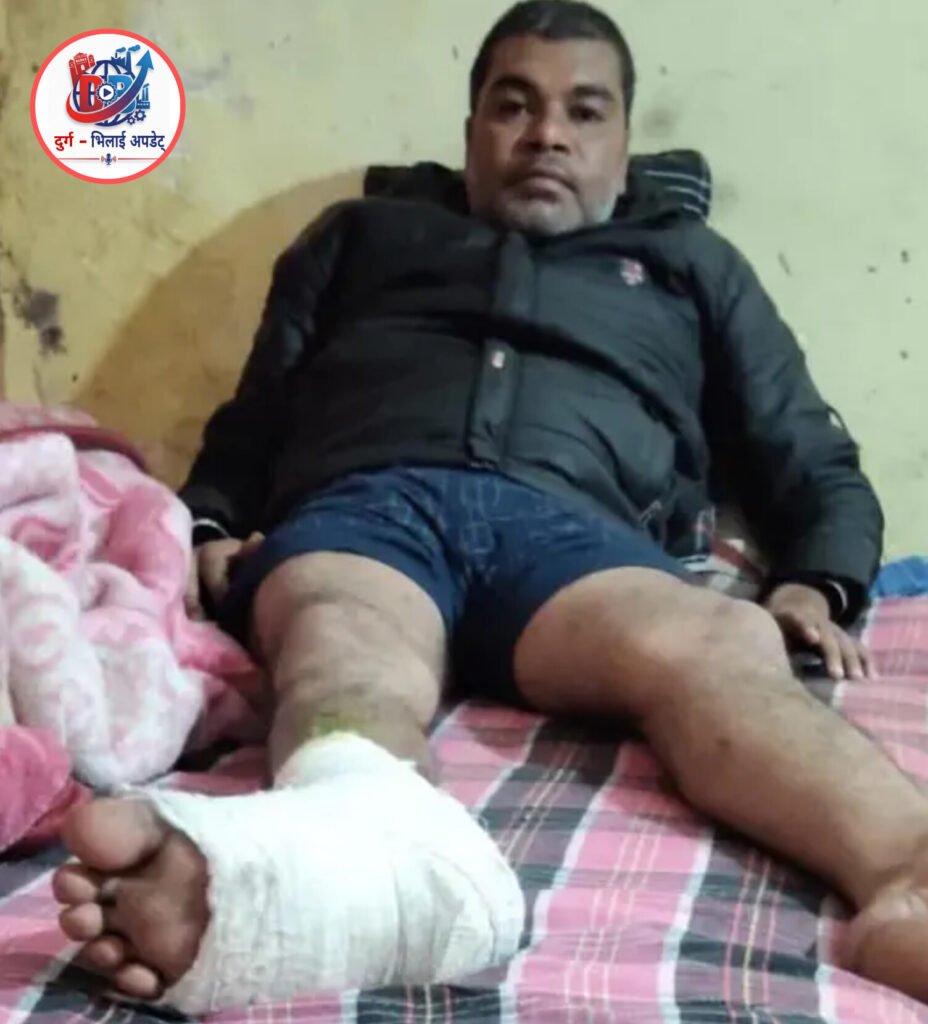 कोरबा में पूर्व युवा कांग्रेस अध्यक्ष पर हमला, चार आरोपियों पर केस दर्ज